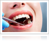 Reasons You May Need a Dental Filling